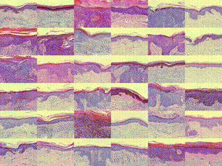 Deep learning in digital pathology